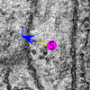Root node